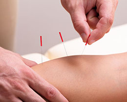 accupuncture to relieve knee pain